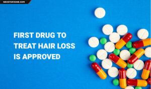 First Drug to Treat Hair Loss is Approved