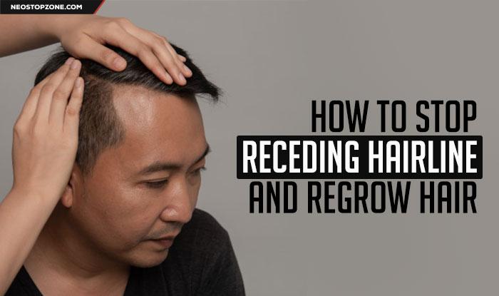How to Stop Receding Hairline and regrow hair