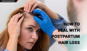 How to Deal with Postpartum Hair Loss