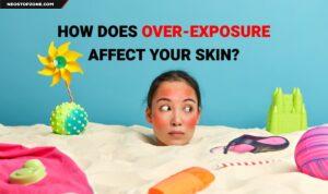 How does over-exposure affect your skin?