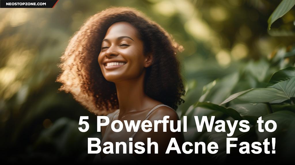 5 Powerful Ways to Banish Acne Fast!